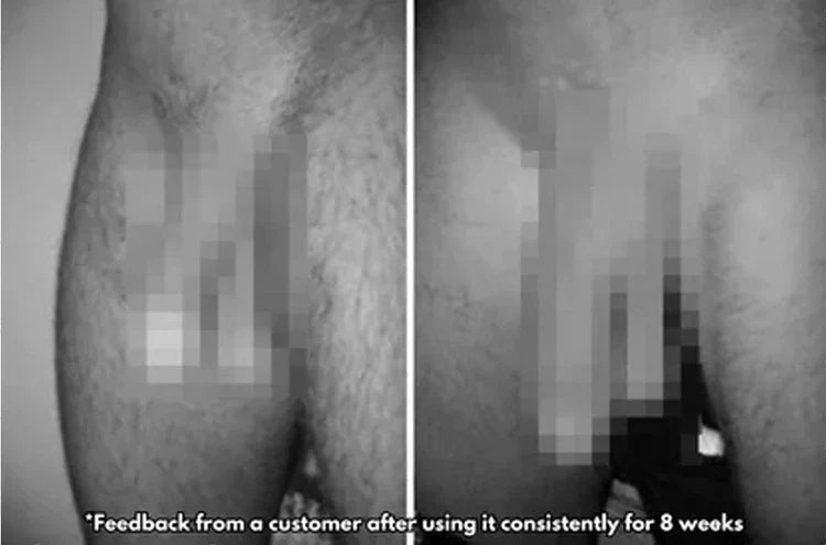 Tiworld™ VitalEngine Pro 5-in-1 at-home trainer that reverses ED